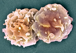 США дали "зеленый свет" исследованиям в области стволовых клеток